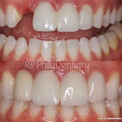 philadelphia cosmetic dentistry